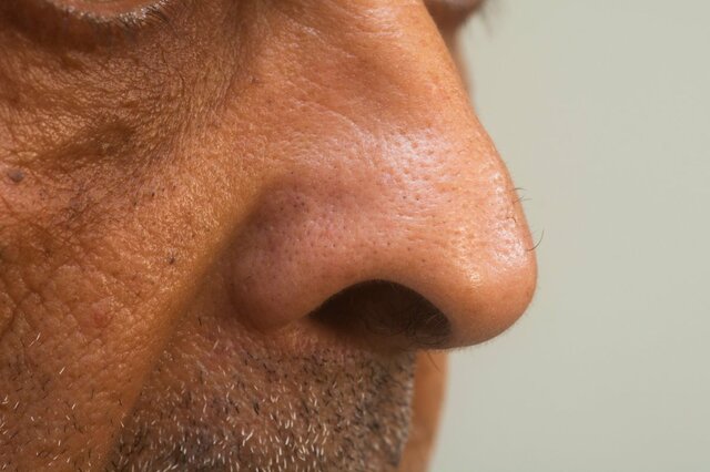 鼻 の 角 栓 とる 鼻の毛穴から白いにゅるにゅるが その正体とは Amp Petmd Com
